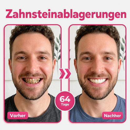 🪥Natravor® Thismile NH-10 Zahnpasta-Serum für Zahnschmelz und Zahnfleisch – Advanced Therapy